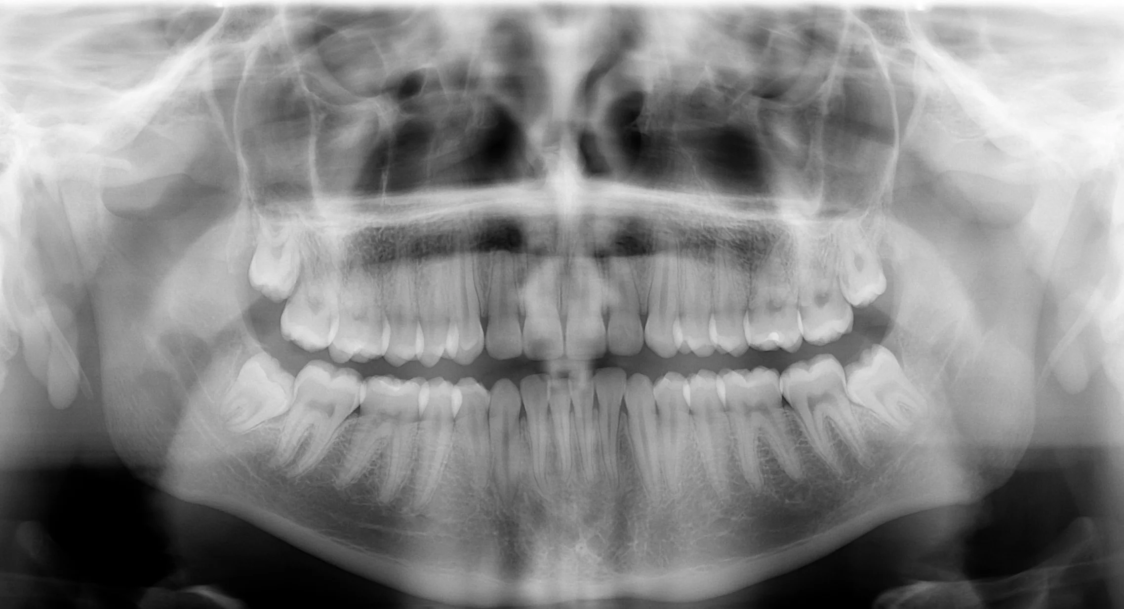 digital dental xrays.jpg
