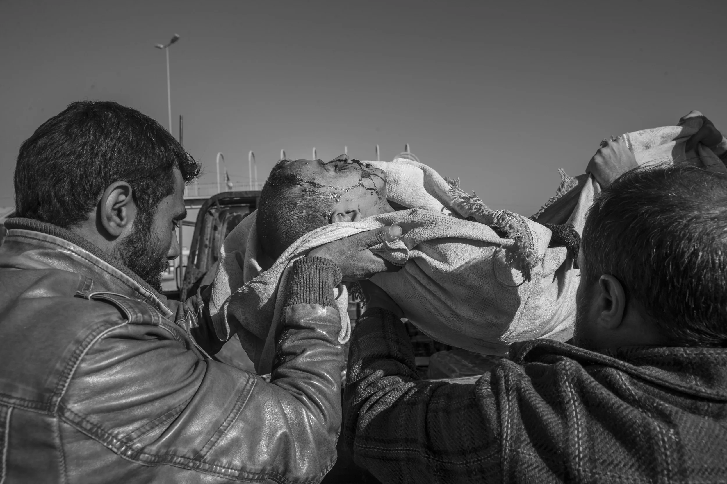  8 year old, wounded in a mortar attack. 