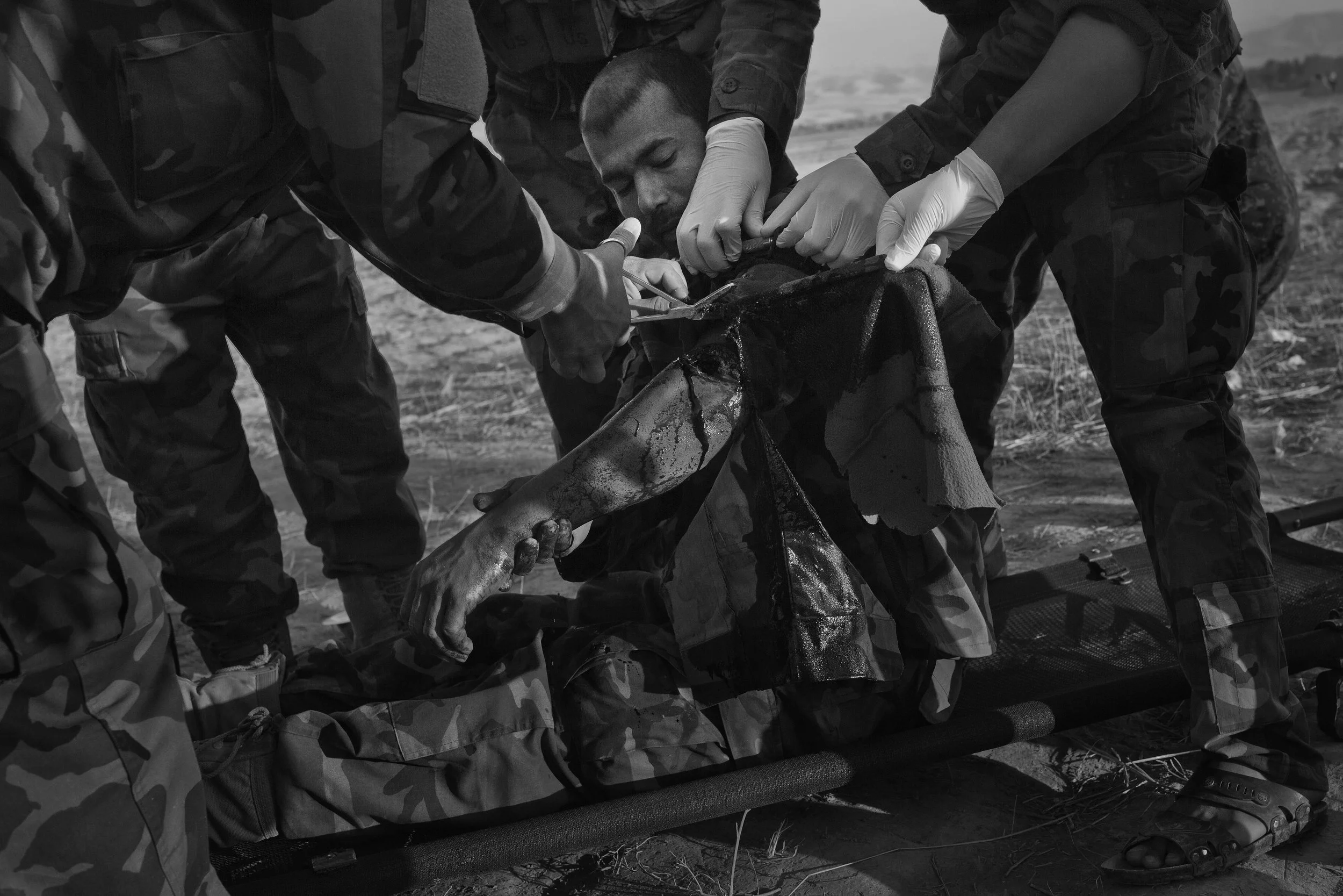  Shot through the arm. 