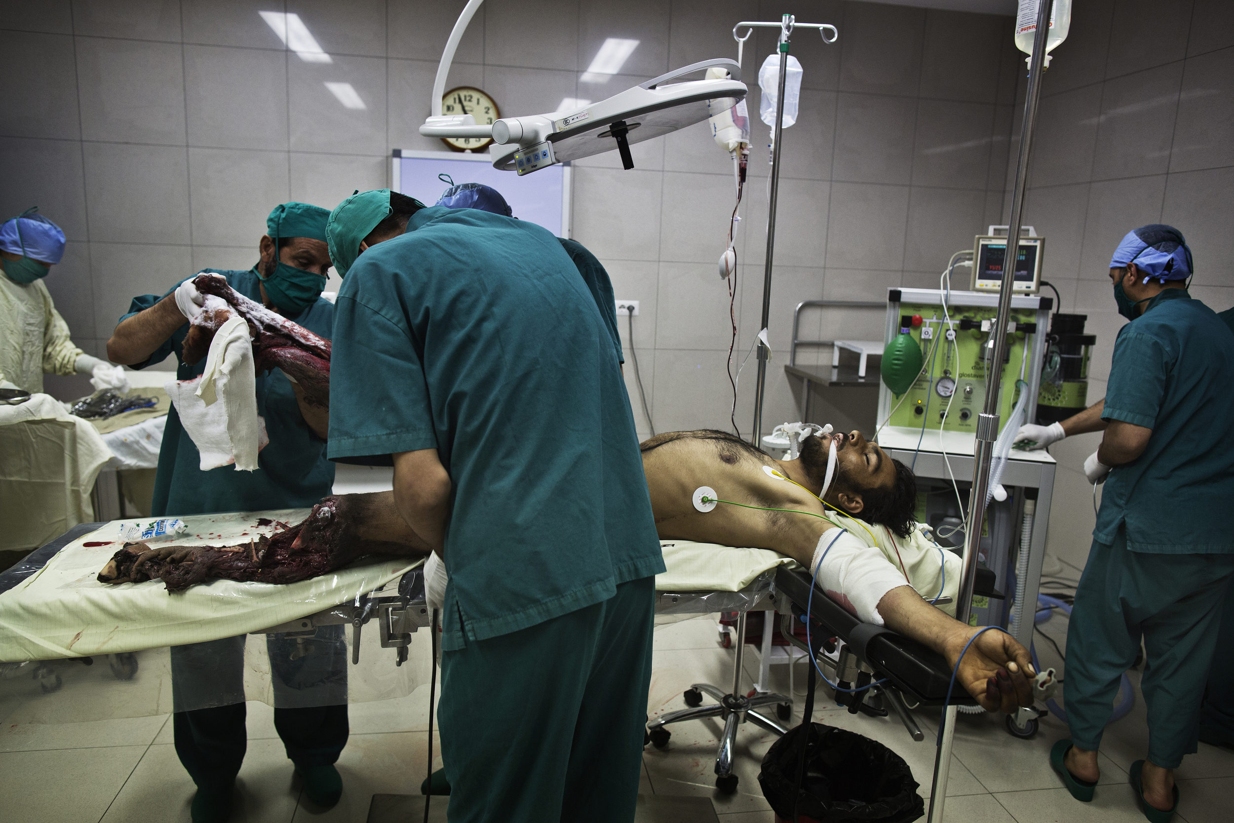  Doctors prepare to amputate the legs of Gula Jan, 35, who was the victim of an IED blast. 
