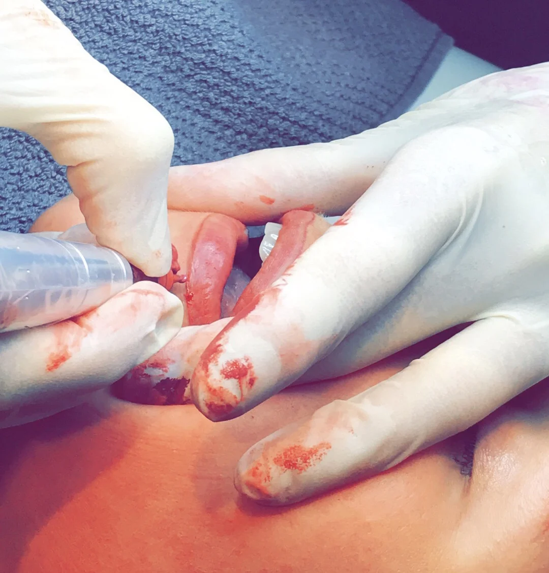 Permanent makeup. Jupp.. Ser grisete ut. Men det er mest leppefarge. Og litt bittelitt blod da 😅 Vi utfører også stråteknikk på bryn og eyeliner av øvre øyelokk.