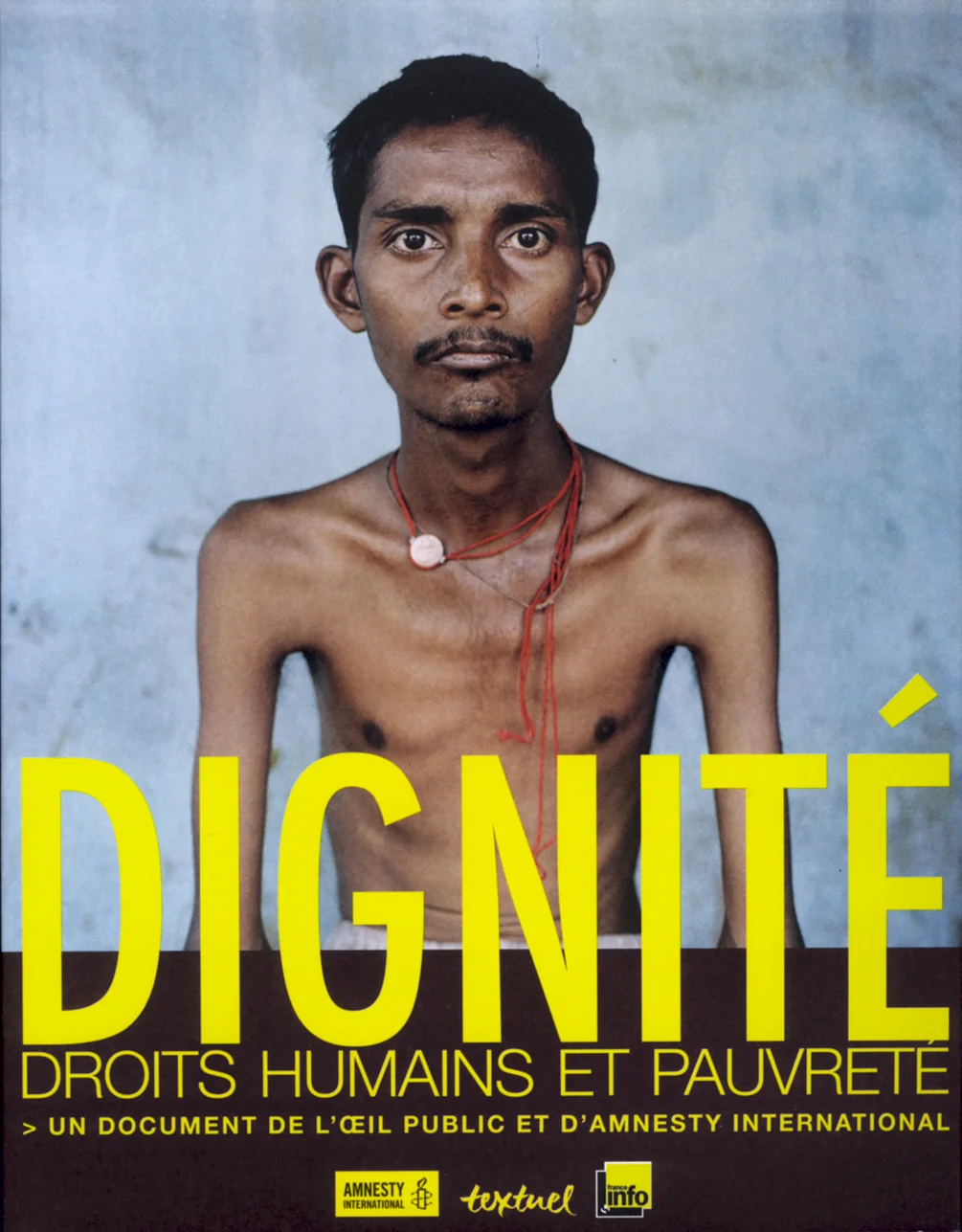 DIGNITE