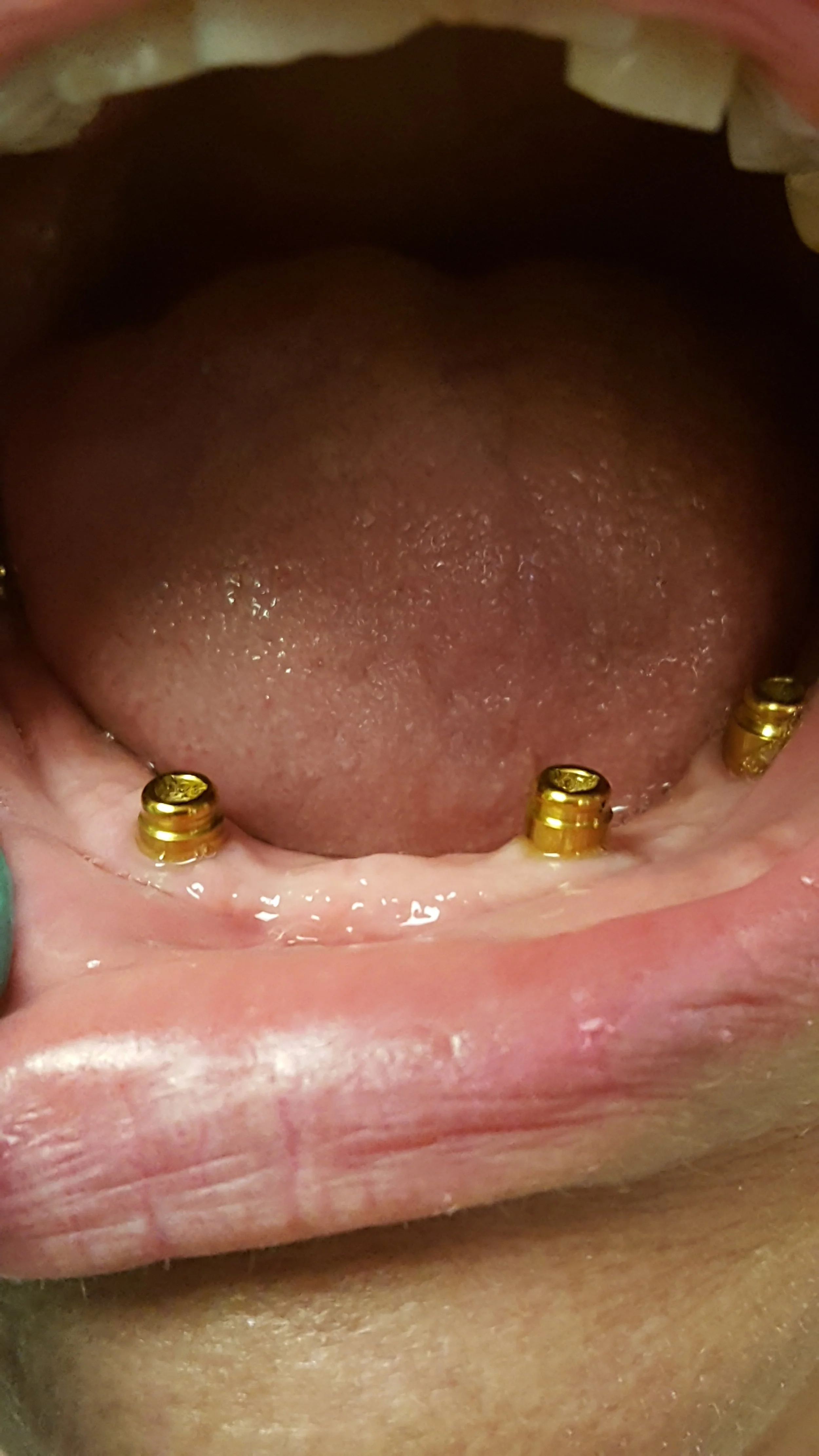 20170822_133801.jpg