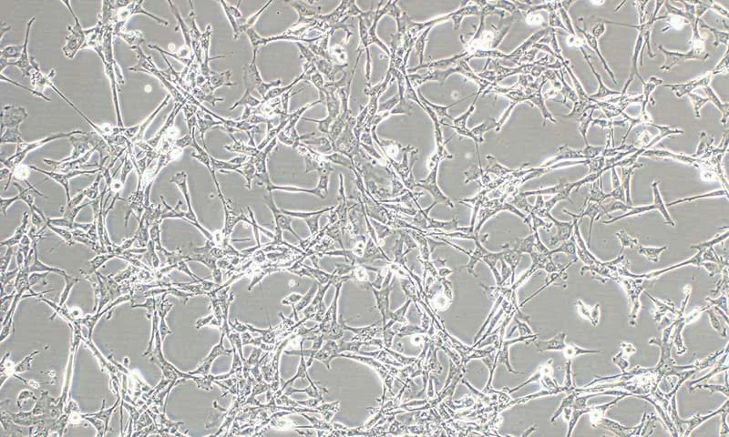 Human Mesenchymal