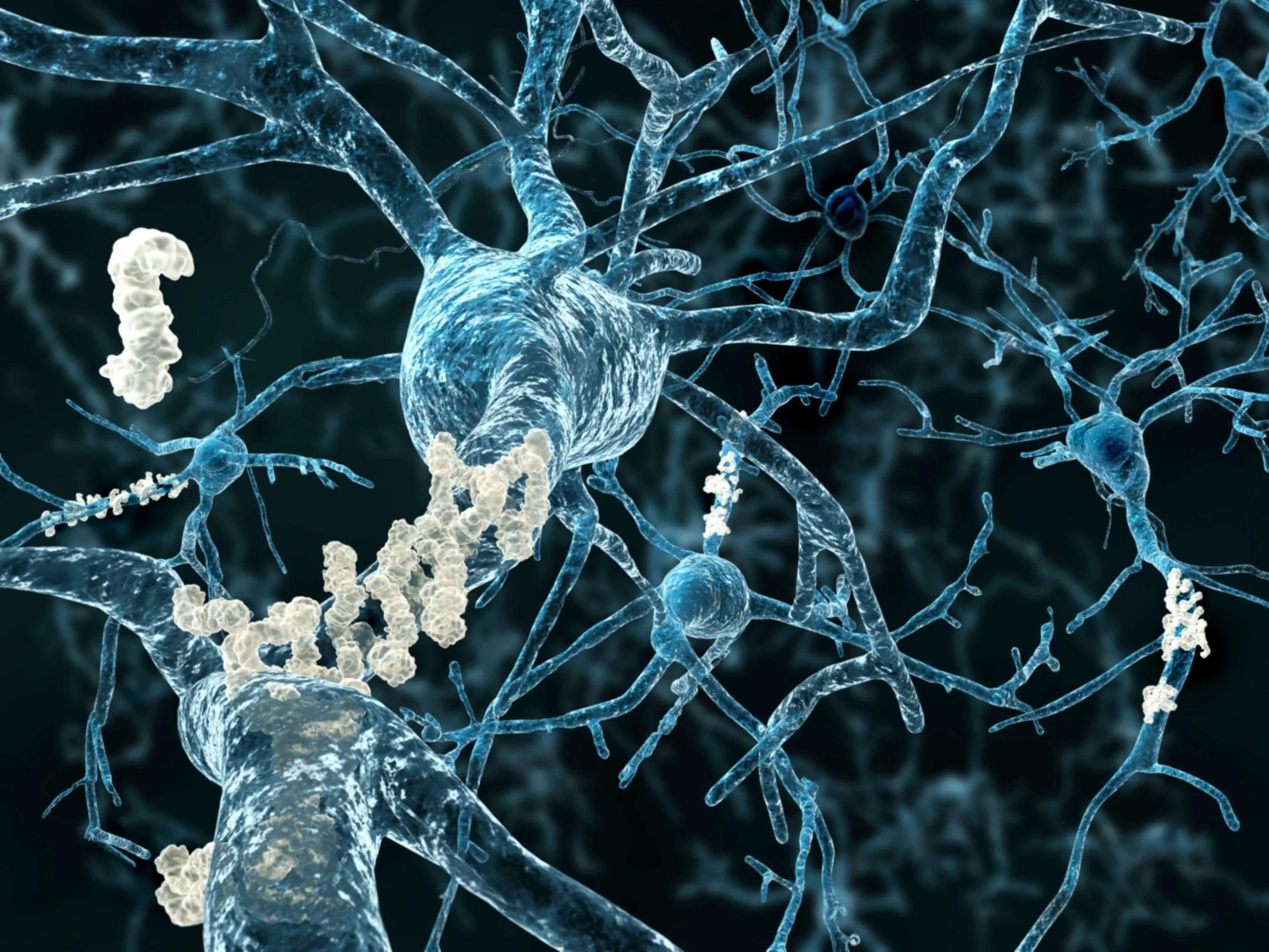home+page+neuron+compressed.jpg