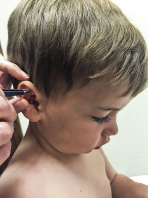 Child with Pressballs
