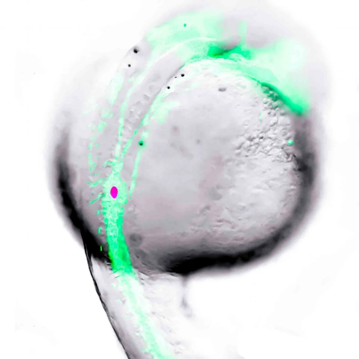 beta-cell development in the zebrafish. one day old transgenic zebrafish embryo with developing vasculature and beta-cells labelled with green and red fluorescent protein, respectively.