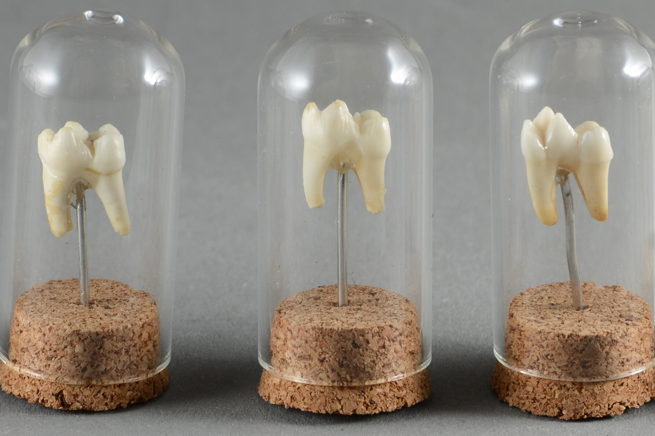 teeth in domes -  cropped.jpg