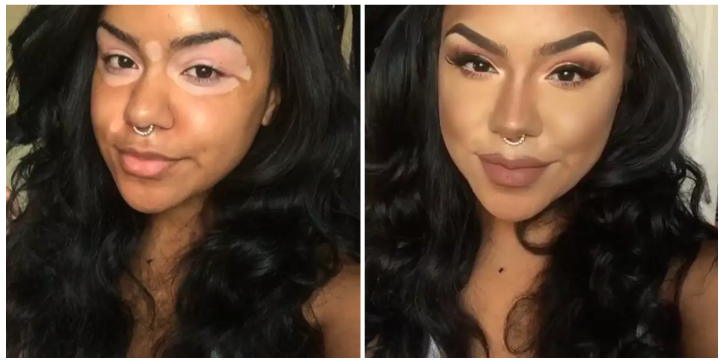 Camouflage Makeup For Severe Skin - Camo Makeup Camouflage Makeup For Severe Skin - Camo Makeup