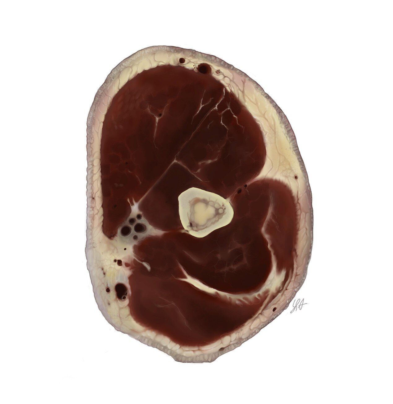 transverse anatomical upper left arm.jpg