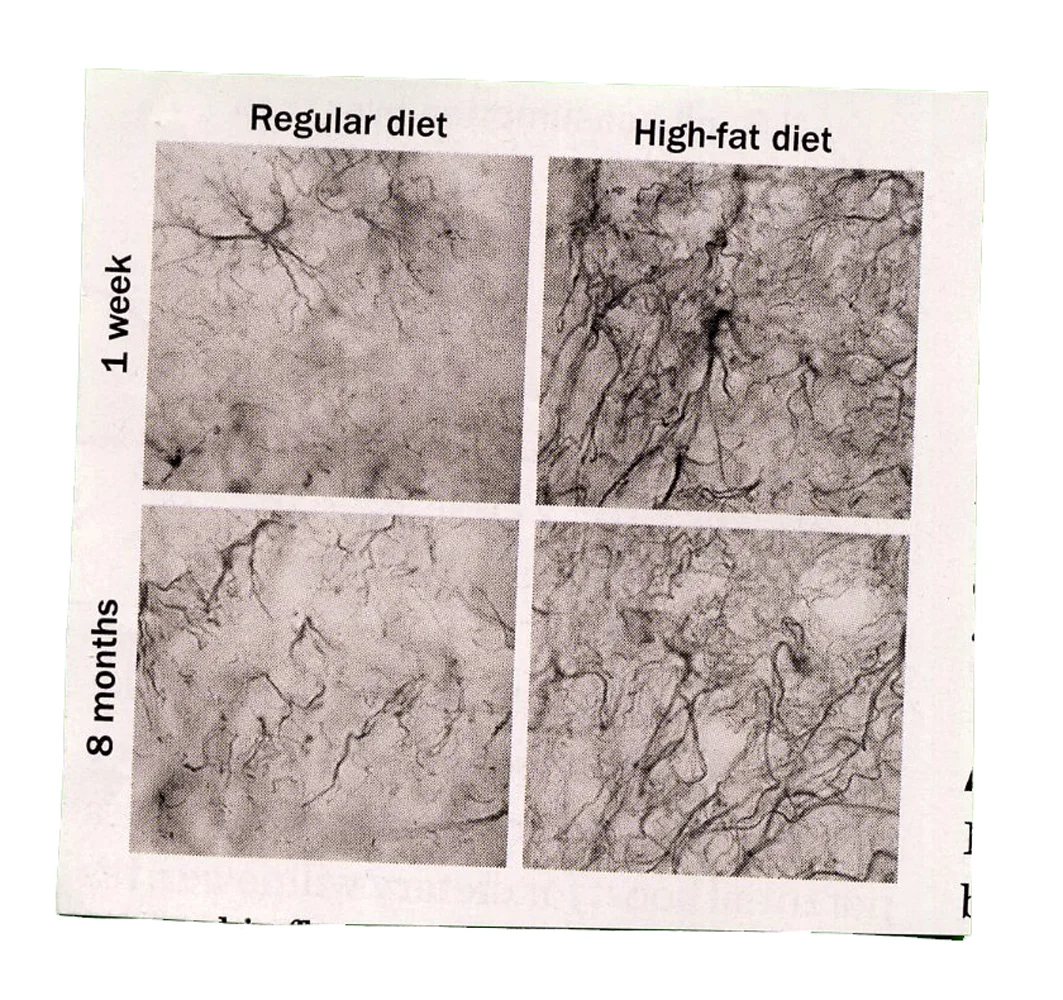 regular diet.jpg