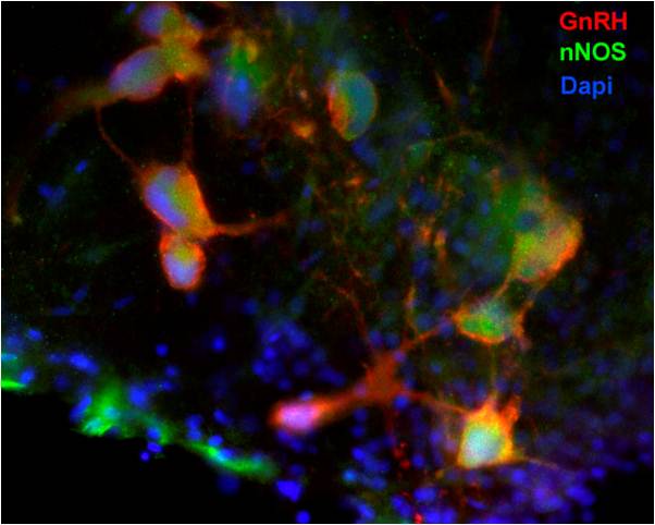 Stained neurons from cichlid brain. Image credit: Karen Maruska.