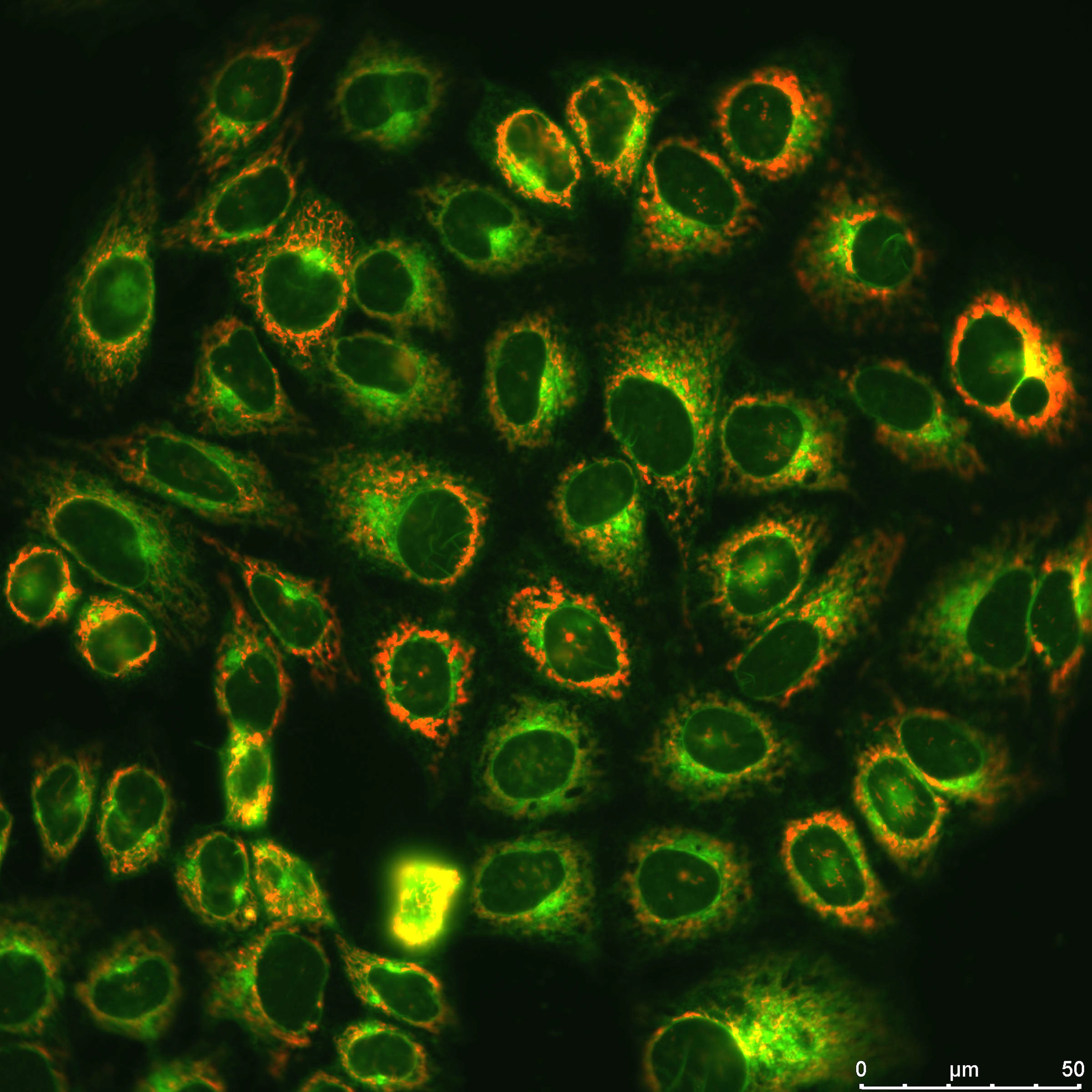 Fluorescent compounds in cells. HEp2 cells stained with ER-Tracker (green) and the target compound, CooBn-BODIPY (red). Image credit: Zehua Zhou, LSU.