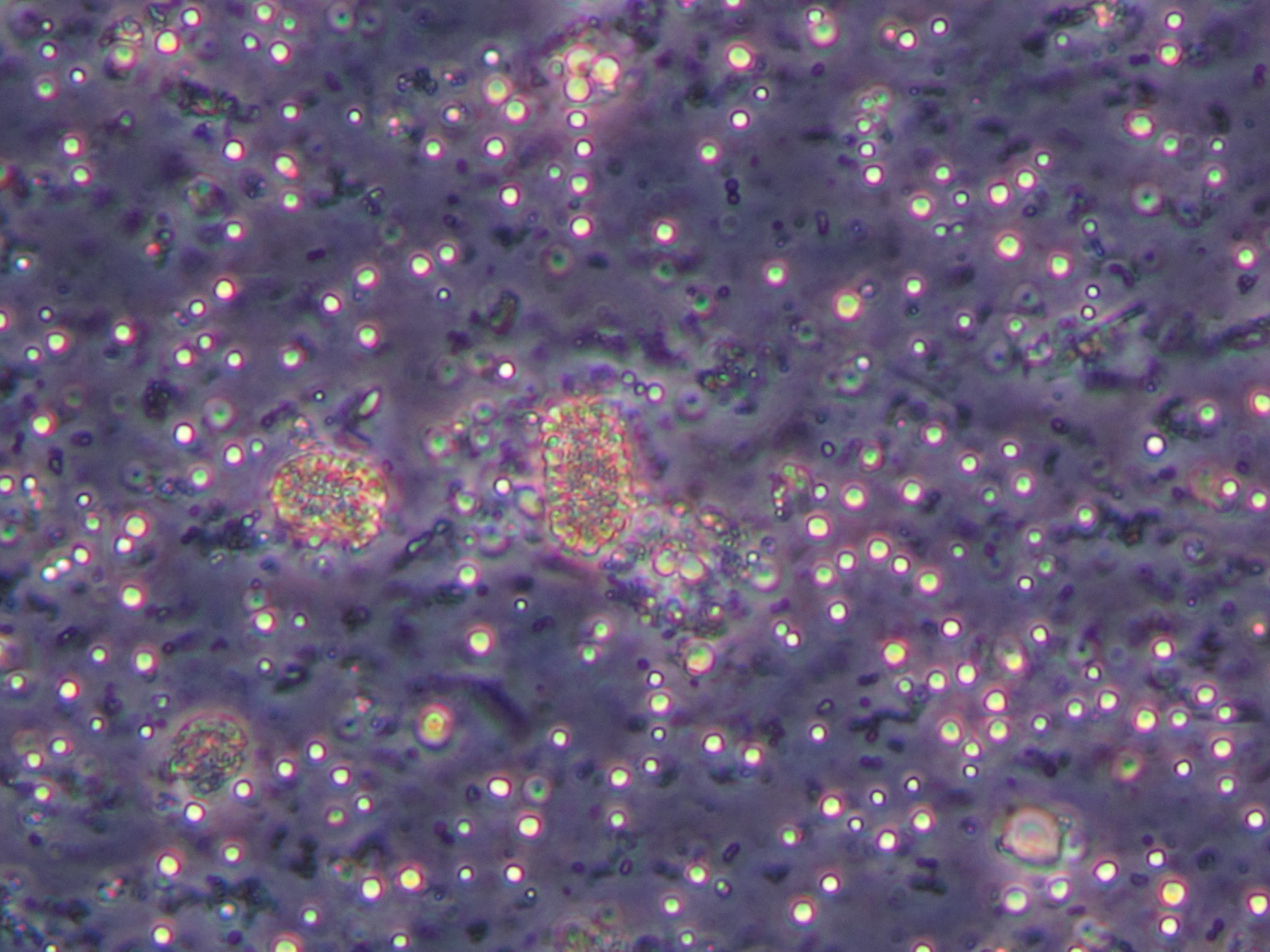 Baculovirus particles under a light microscope. Credit: Bret Elderd/James Reilly.