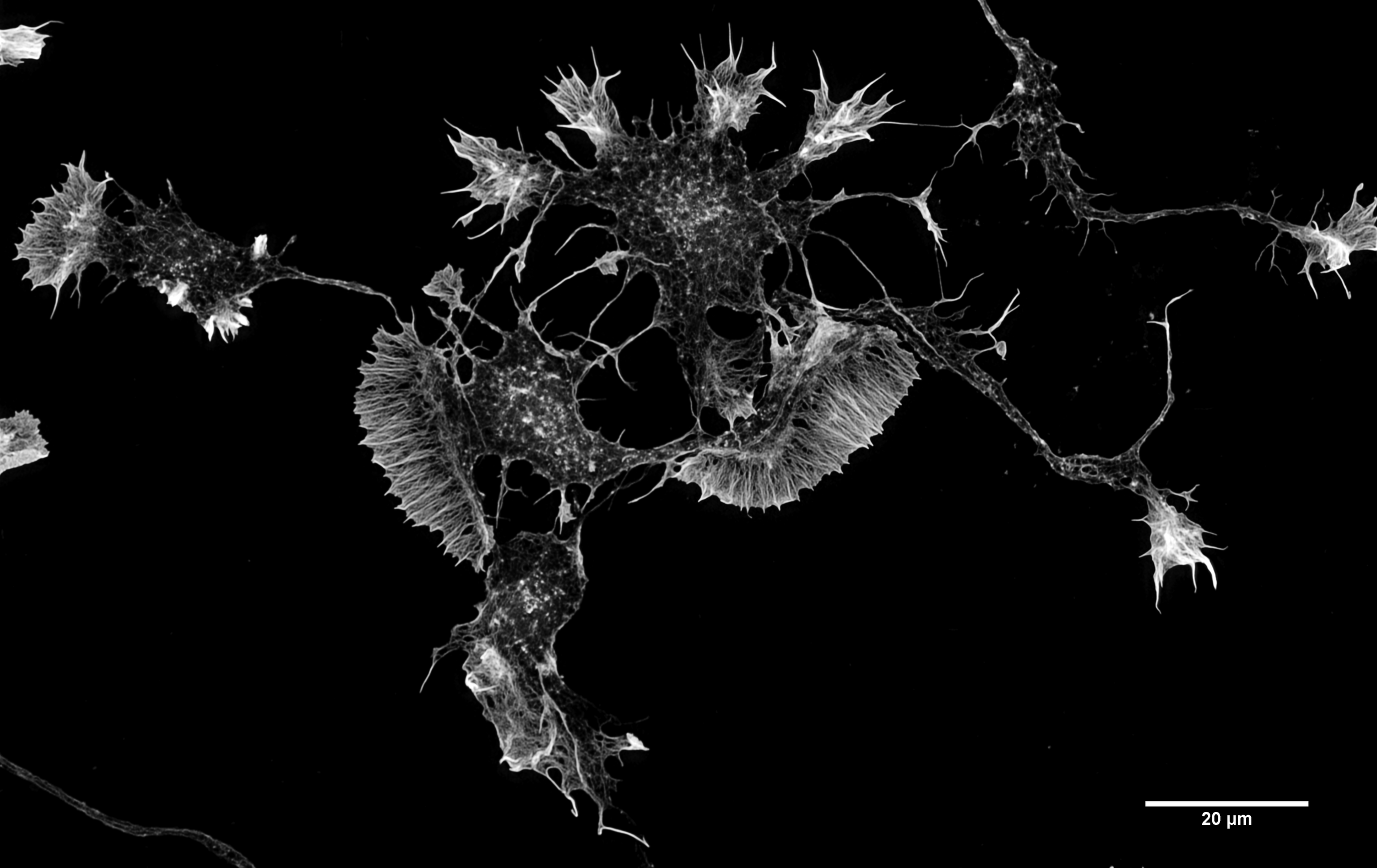 Actin filaments in a mouse Cortical Neuron in culture, by Howard Vindin , Wiki.