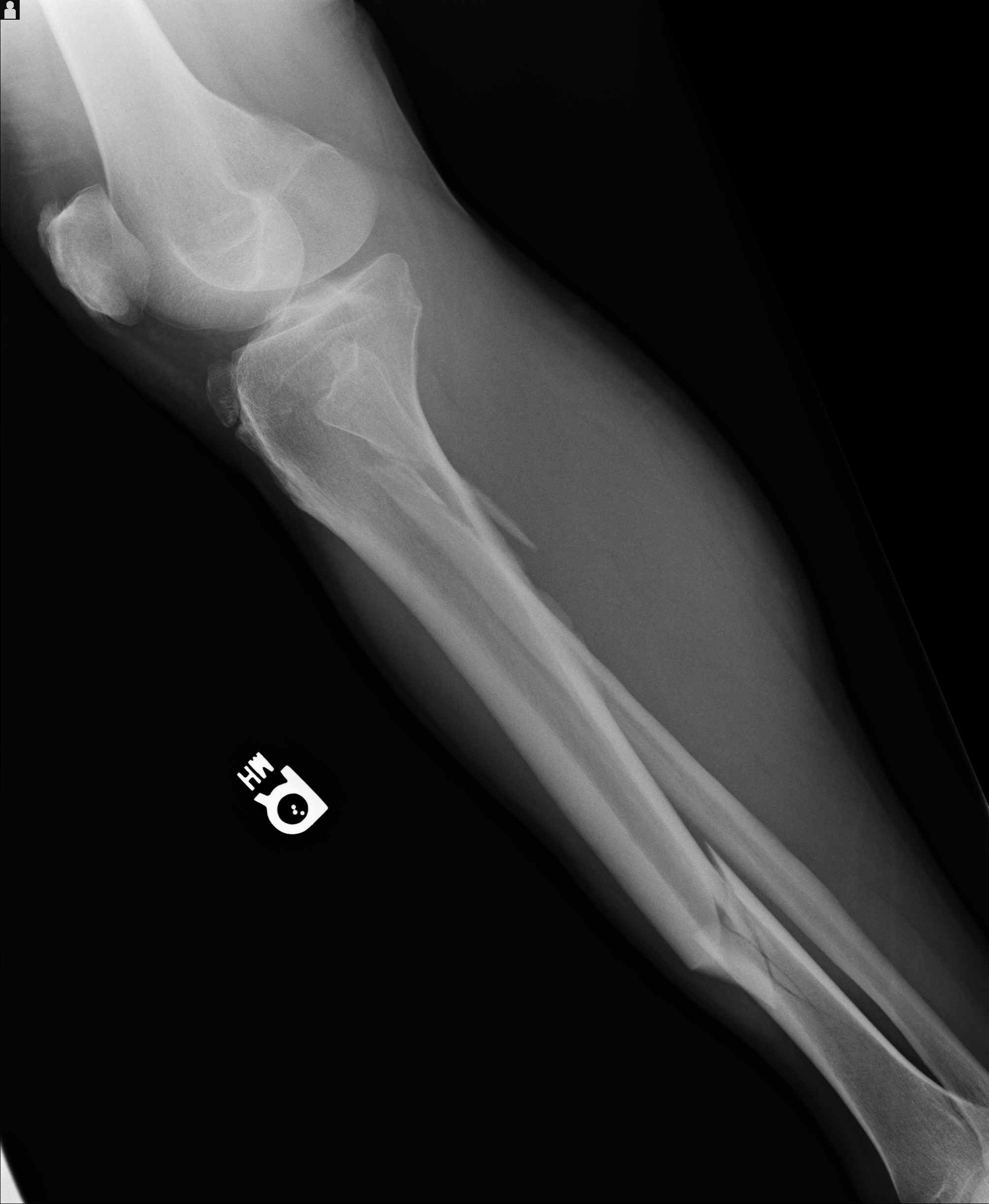 leg-ct-scan.jpg