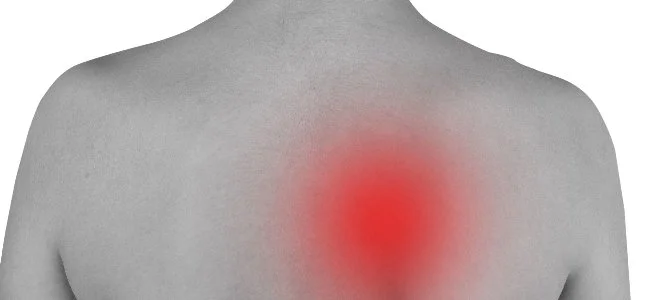 Interscapular Pain Causes: Beyond the Shoulder Blade Discomfort