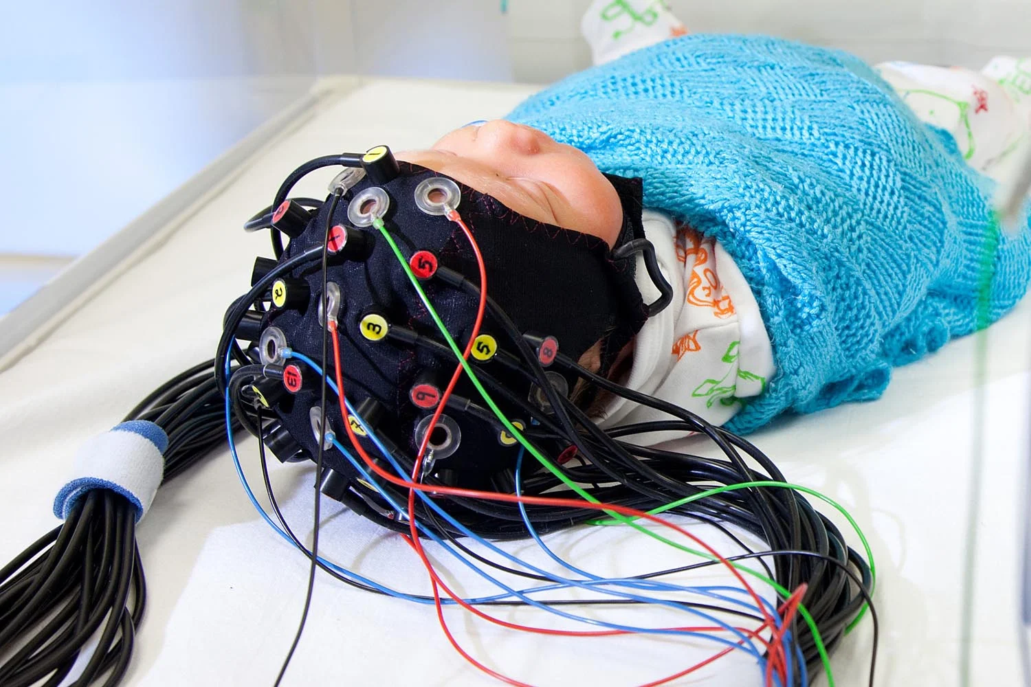 Neonatal fNIRS Imaging