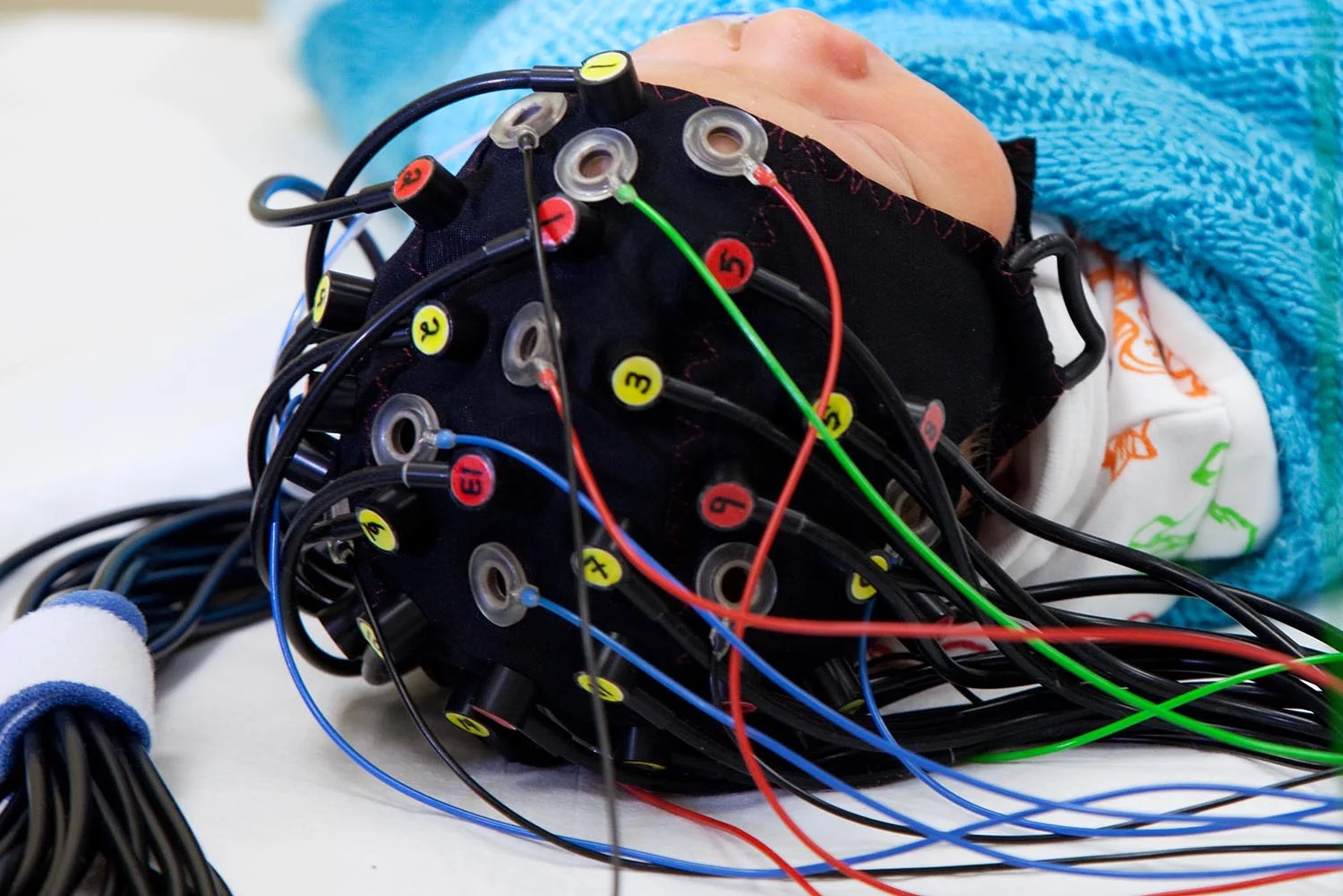 Gowerlabs Neonate Headgear