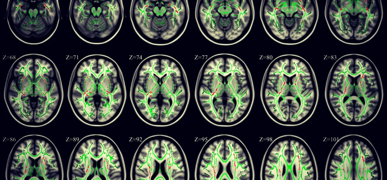 Research Shows That Physically Complaining Rewires Your Brain To Be Depressed And Anxious