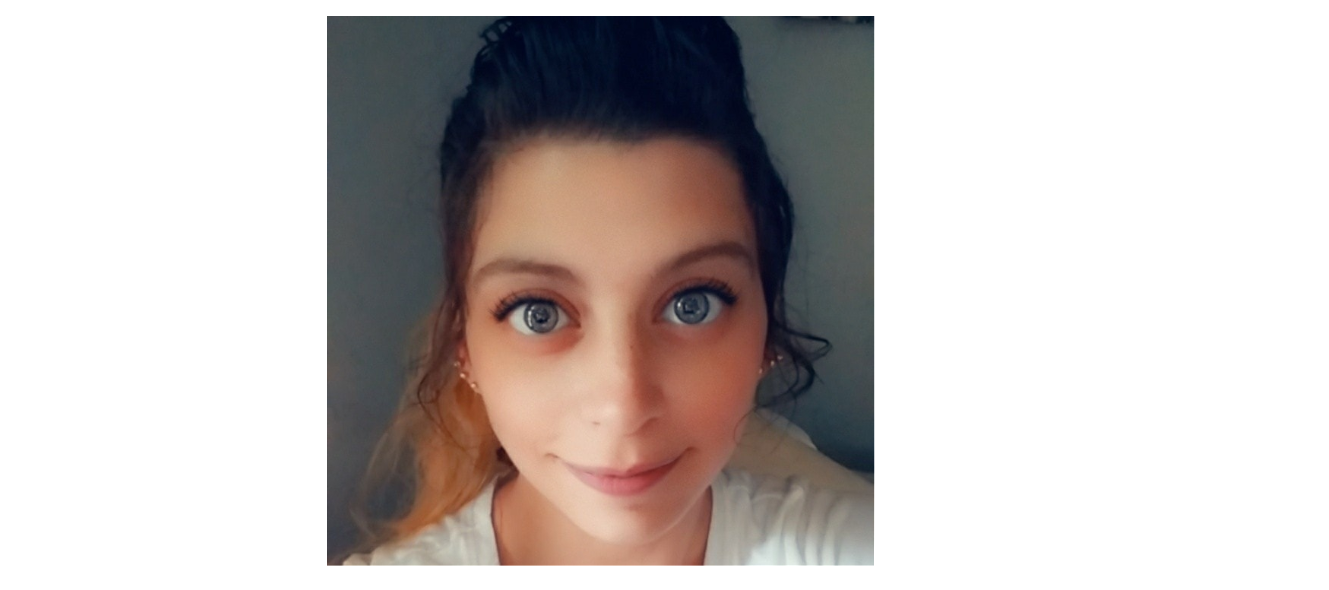 Beautiful Eyes! Zippy! #eyes #ohio #beautiful #zippy
