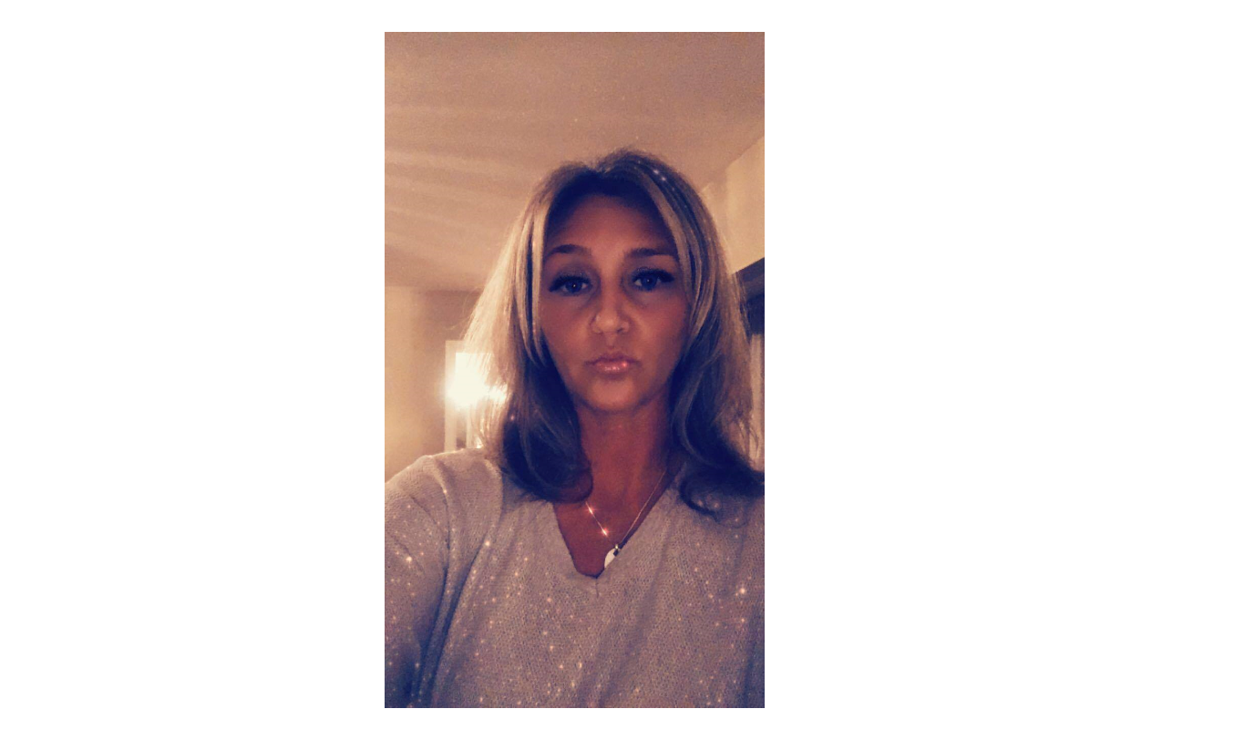 Beautiful Wound Care Nurse Lisa! #noblebeauty #nurse #lisa