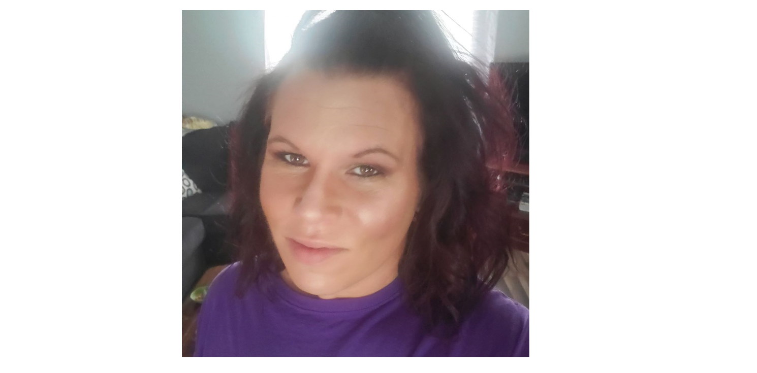 Beautiful Health Technician Carly! #noblebeauty #ohiobeauty #carly