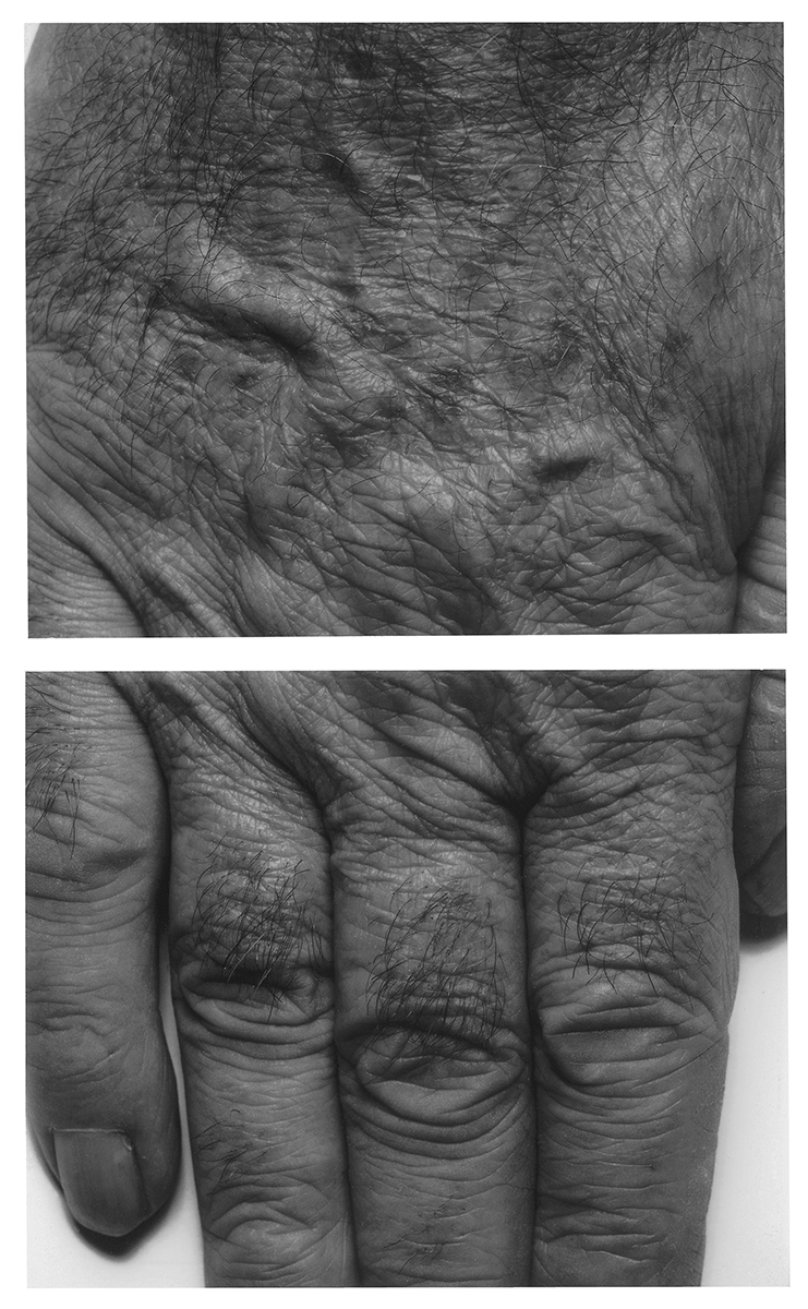 Hand, Two Panels, Vertical, 1988