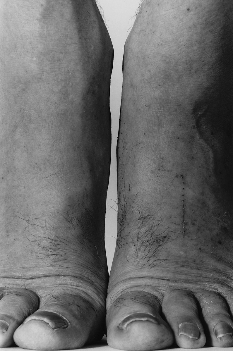 Feet Frontal, 1984