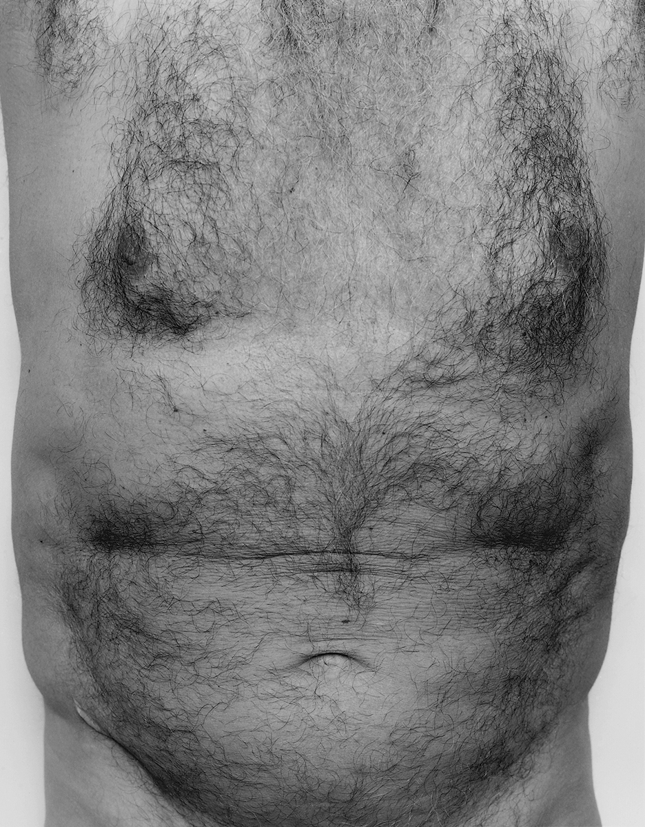 Torso, Front, 1984