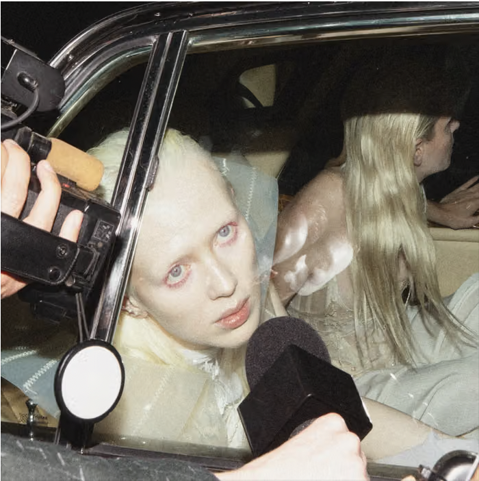 Static Dress Kills Nostalgia in New Album “Injury Episode”