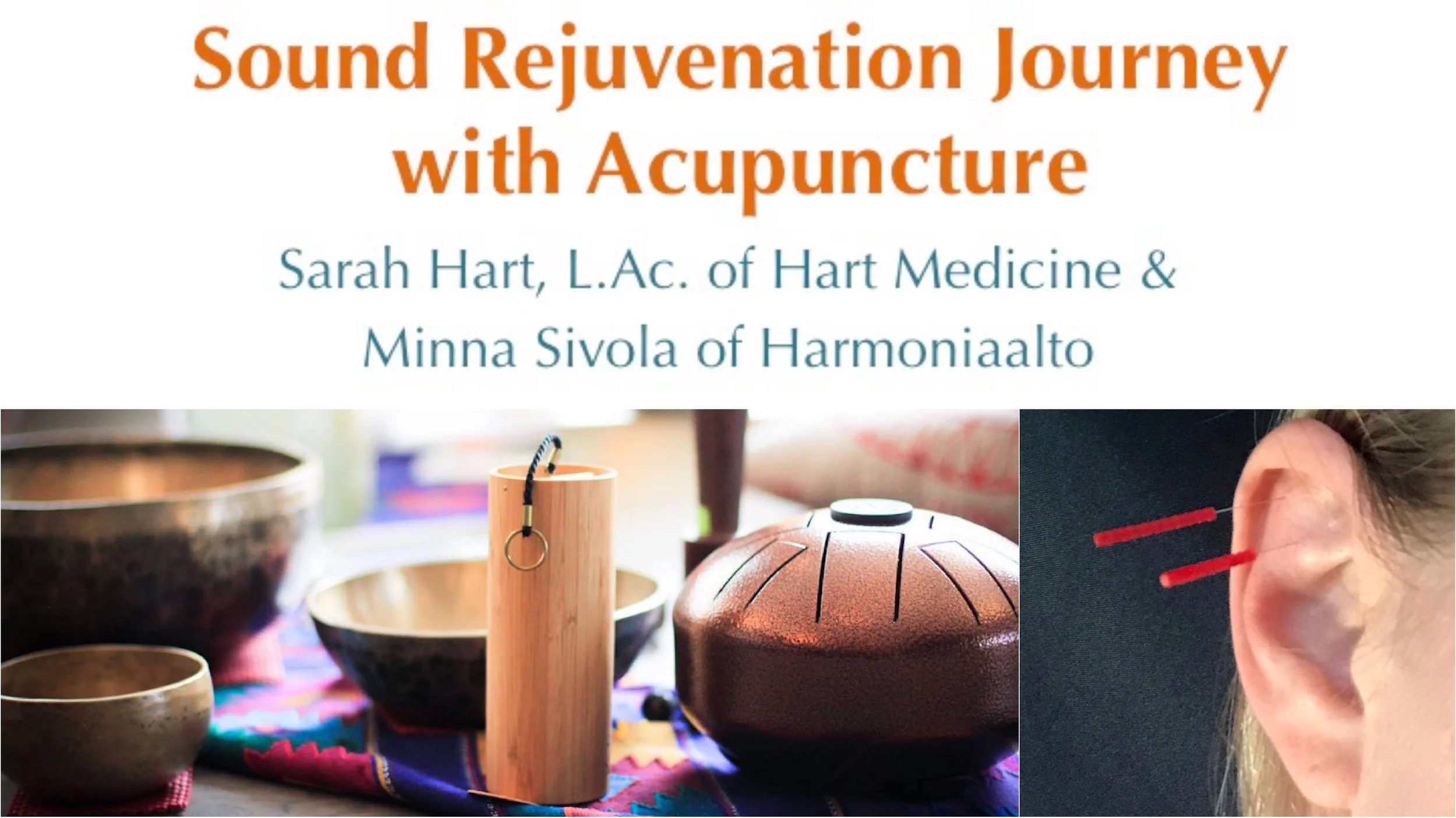 Sound Rejuvenation Journey with acupuncture.jpg