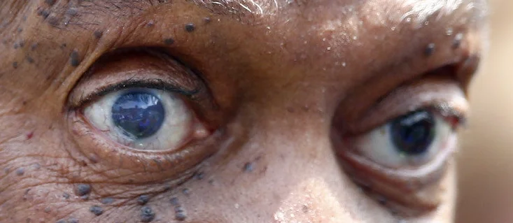 Bill Cosby is legally #Blind