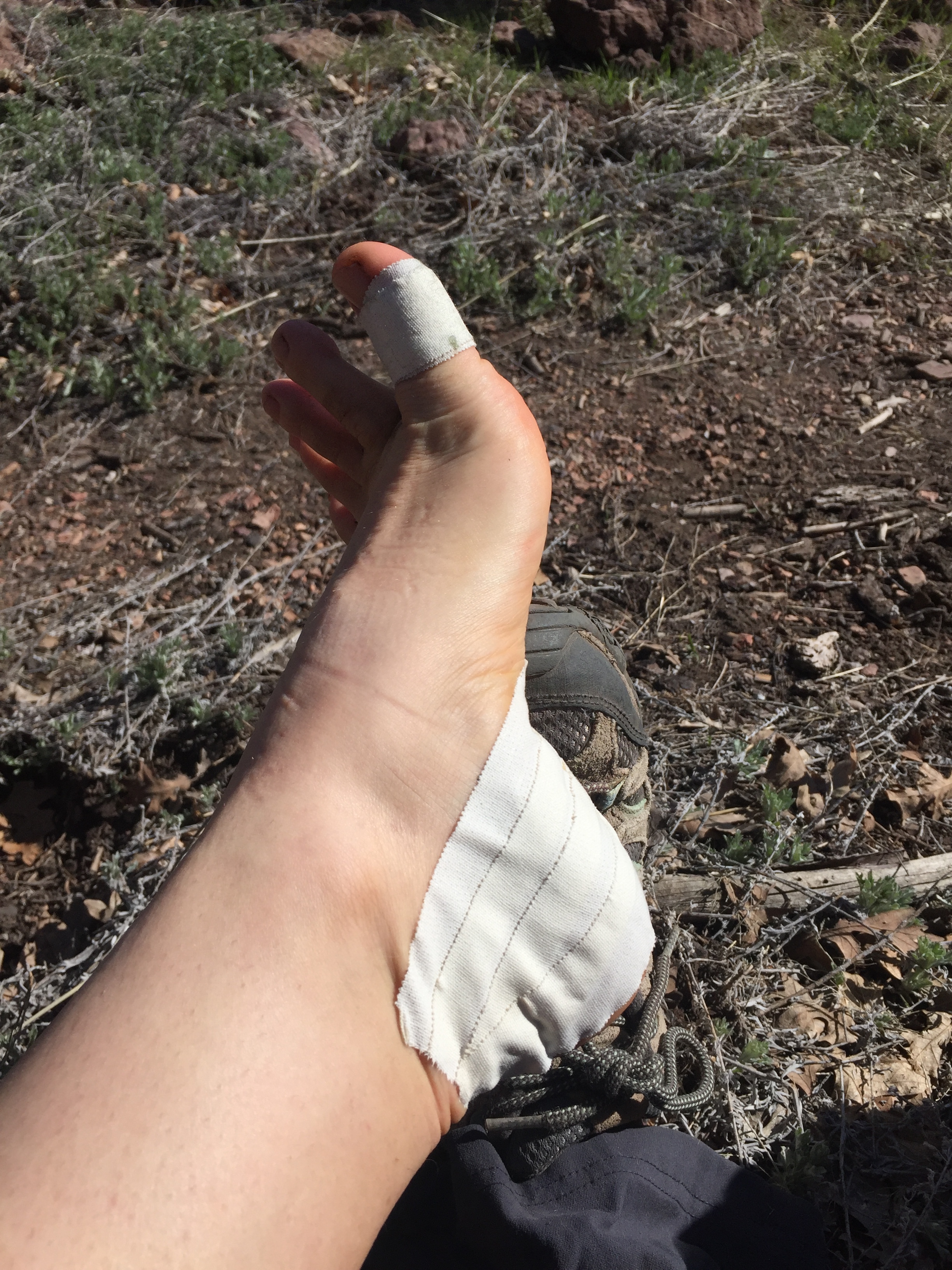 The state of the feet. Not great. 