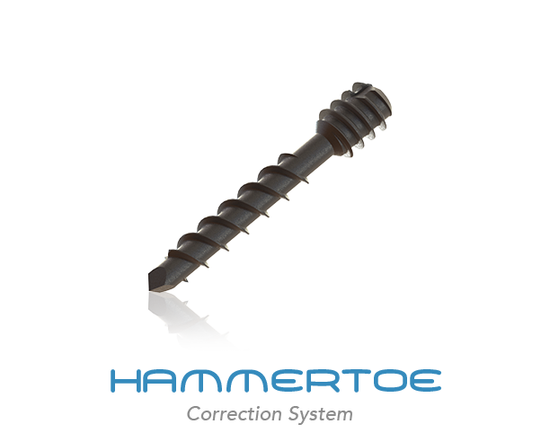 HAMMERTOE-NEWs.png