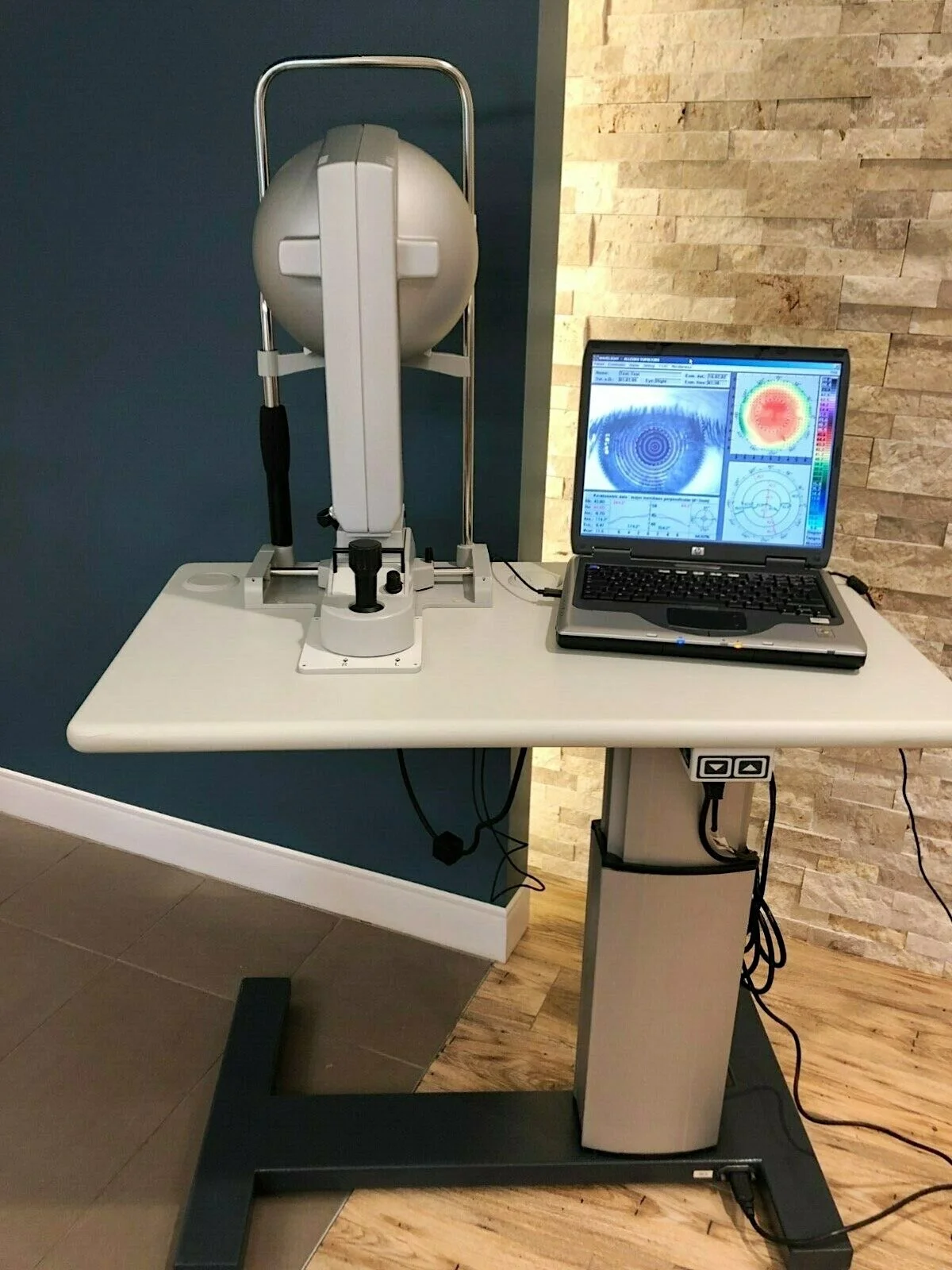 Topolyzer model 1075