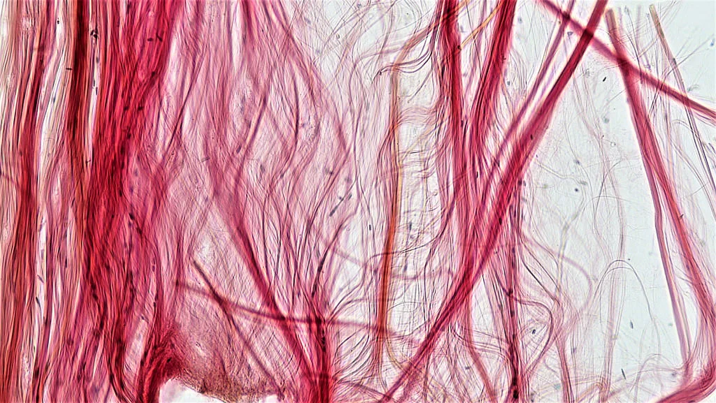 Connective tissue: Tendon