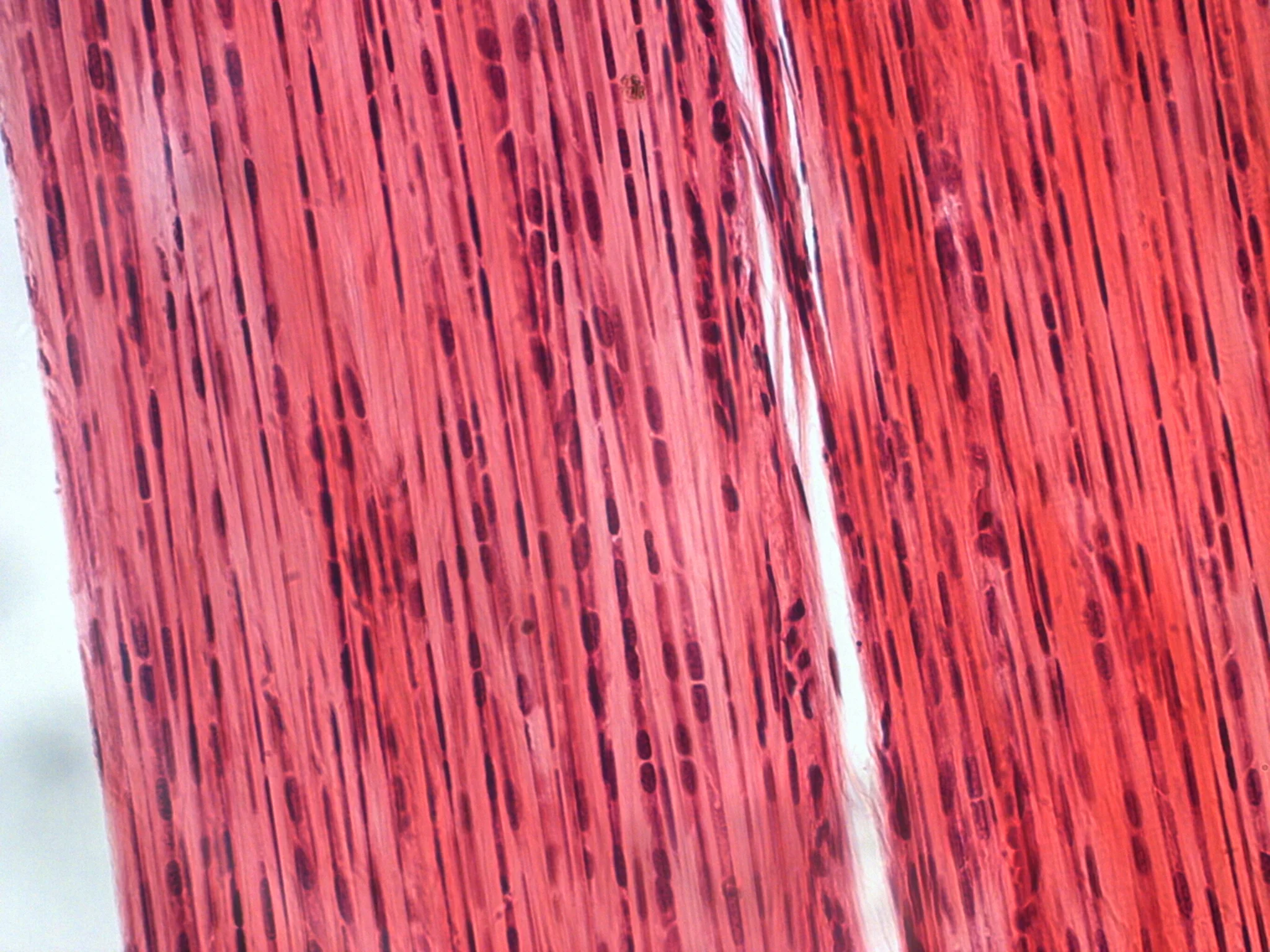 Dense connective tissue