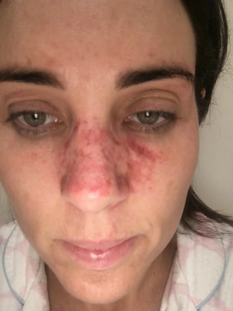 Efudix  www.efudix.com.au