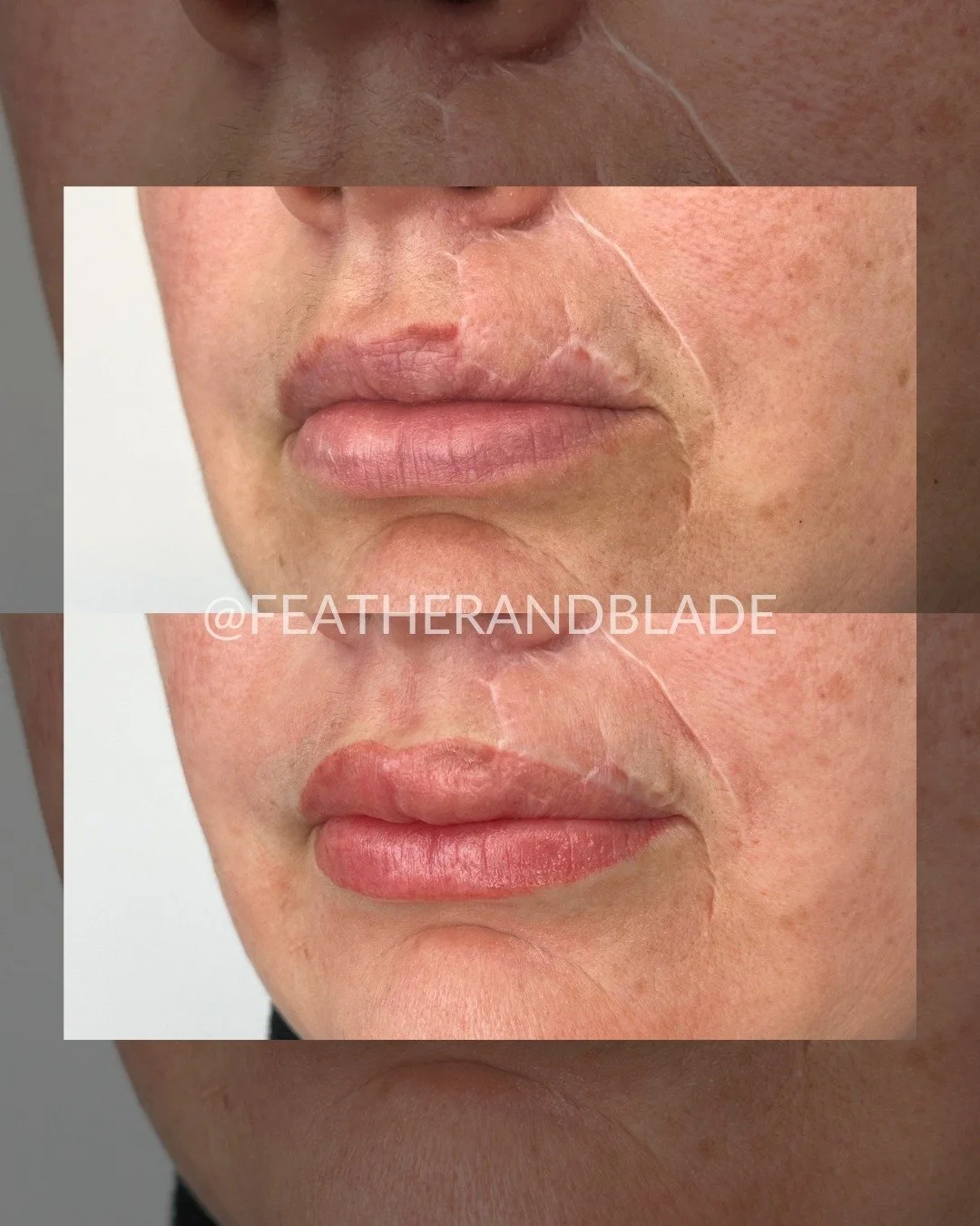 Starting off October strong with some fan-favorite lip blushing work! This is a great example of how our work can be restorative as well as cosmetic🩷👄

What is lip blushing?
Lip blushing is a form of semi-permanent makeup. It is a cosmetic tattoo o