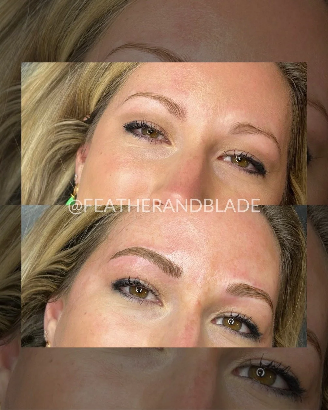 What is microblading?

Microblading is a semi-permanent makeup procedure that creates life-like hair strokes in your brow area. This is done by inserting cosmetic tattoo pigments into the dermis layer of the skin. Microblading is also known as brow f
