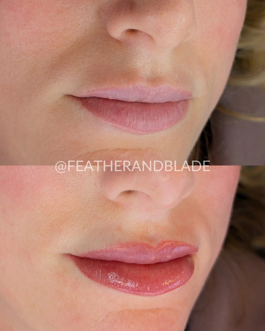 Freshly blushed 👄

Lip blushing is a customizable cosmetic tattoo of the lips that enhances the beauty of the natural lip color, defining the lips' shape and giving the illusion of fullness. It uses soft pigment for a natural tint that lasts, reduci