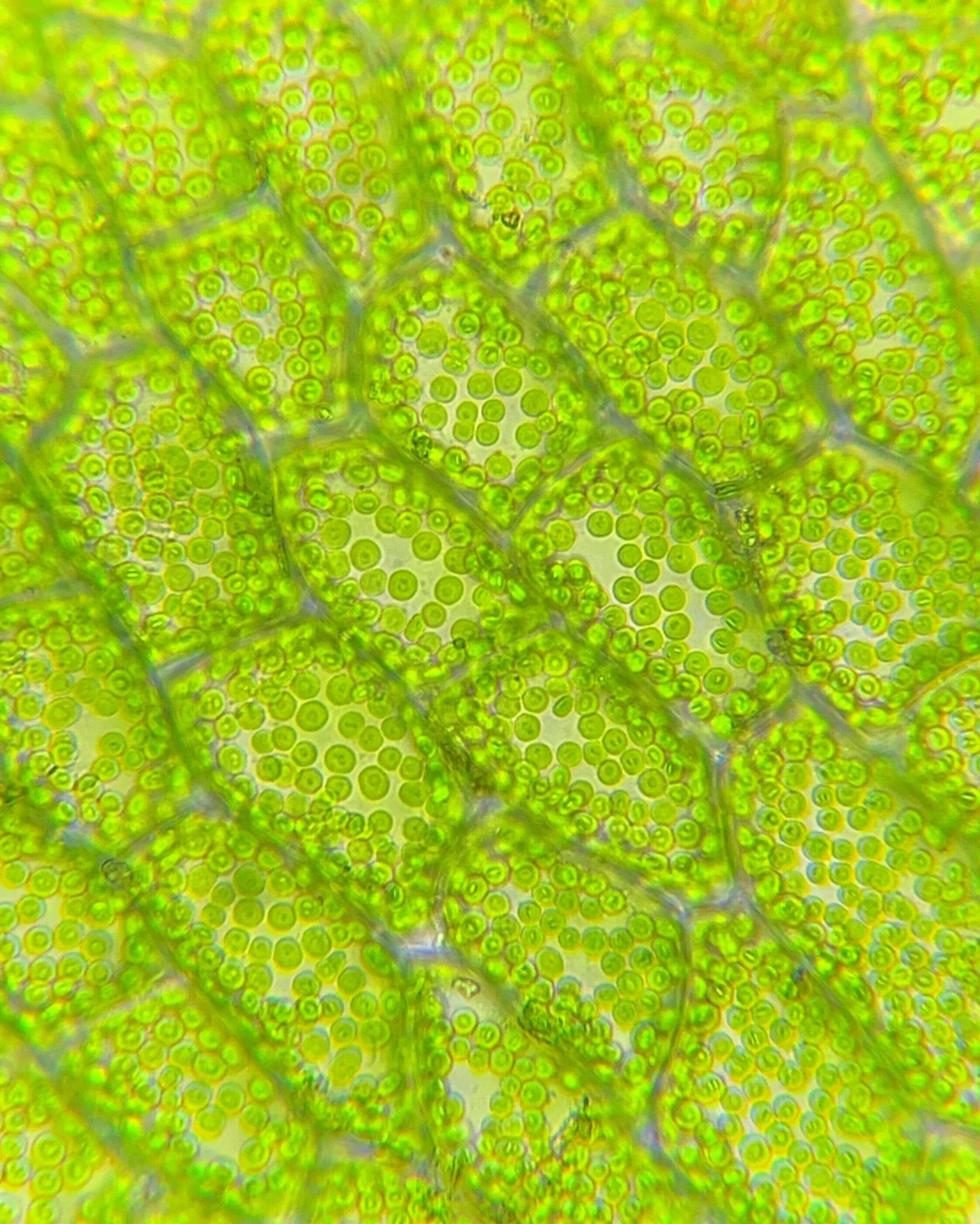 Chloroplasts inside plant cells at 400x