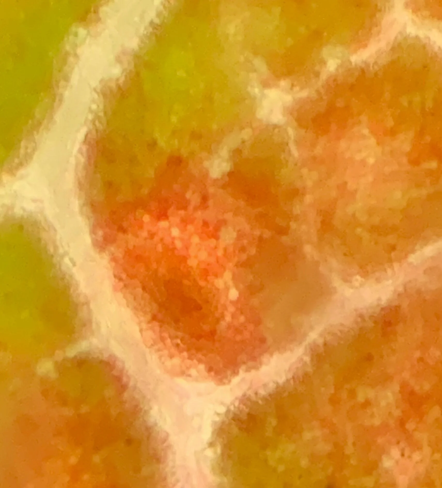 Different fall pigments at 100x