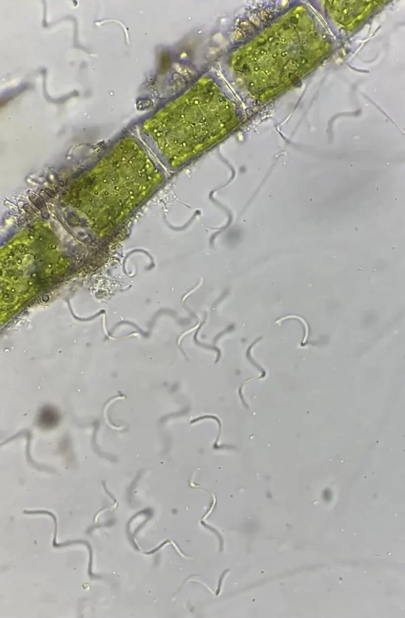 Bacteria- Spiral shaped bacteria (Spirilla)