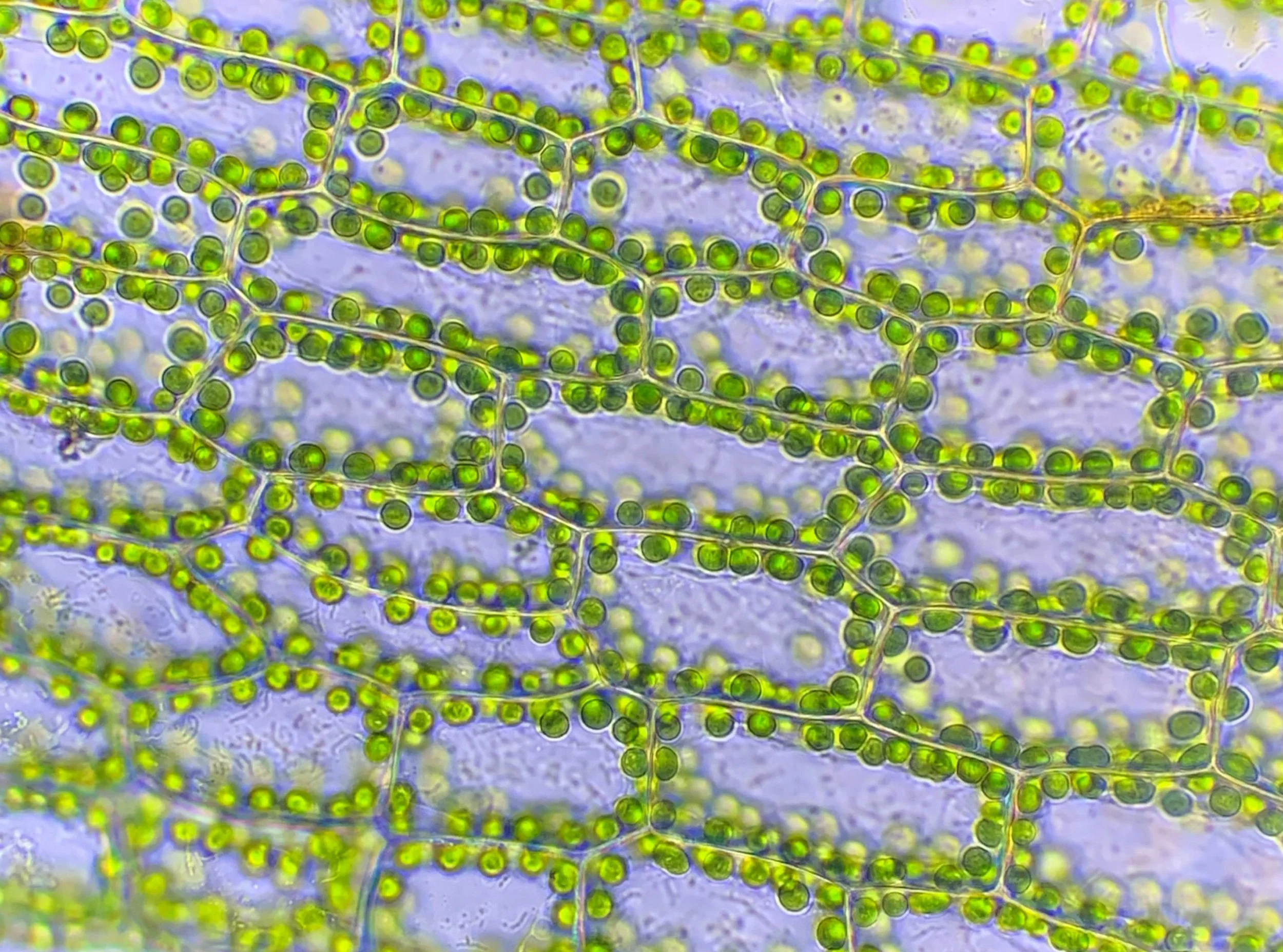 Moss chloroplasts at 400x