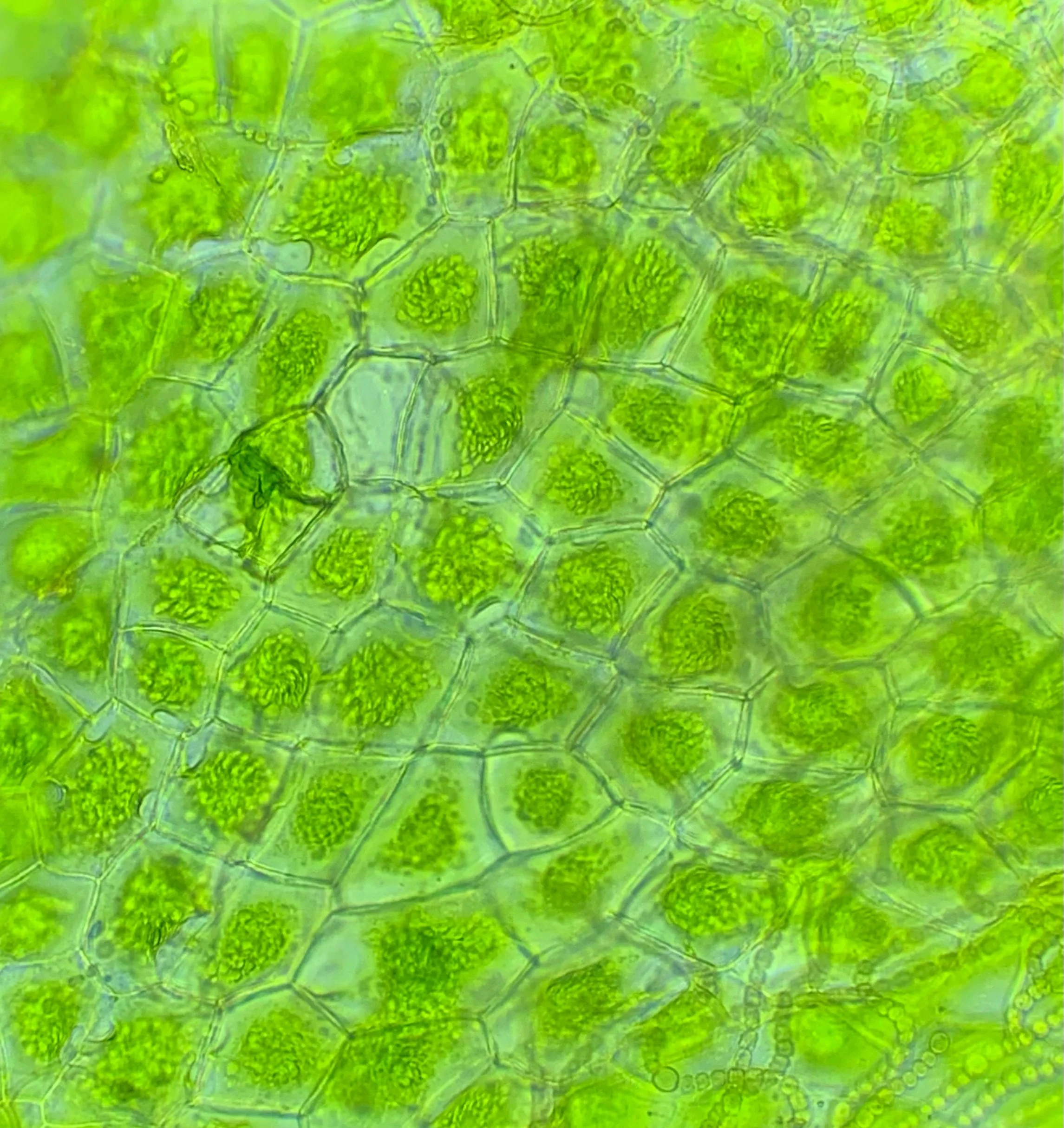 Hornwort chloroplasts at 400x