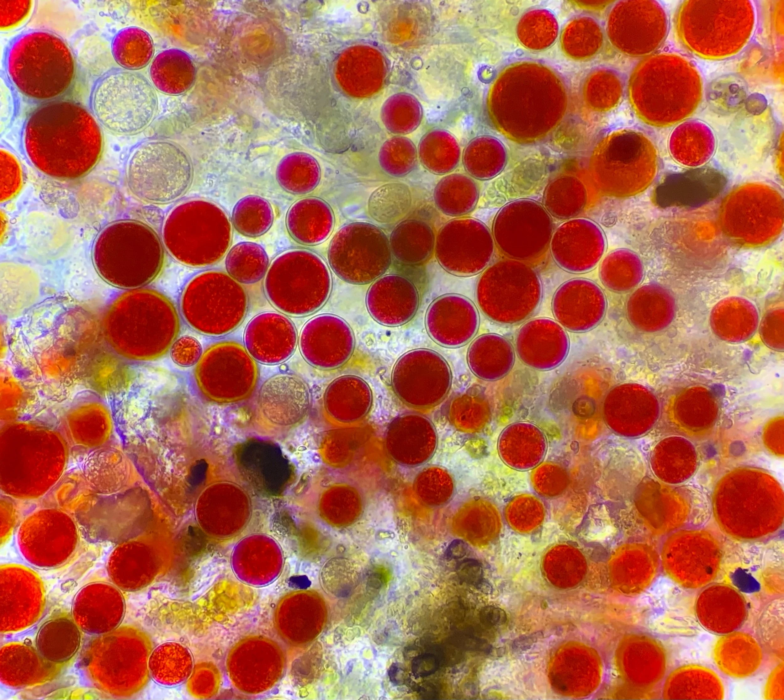 Haematococcus cyst cells with the reddish orange carotenoid pigment called astaxanthin at 400x