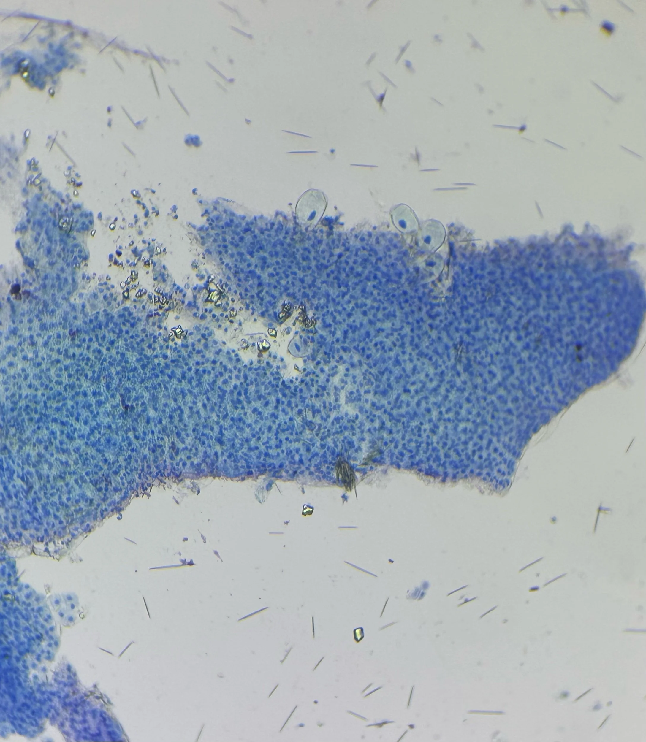 Stained meristematic orchid cells "resting" in interphase surrounded by needle like calcium oxalate crystals (raphides) at 100x