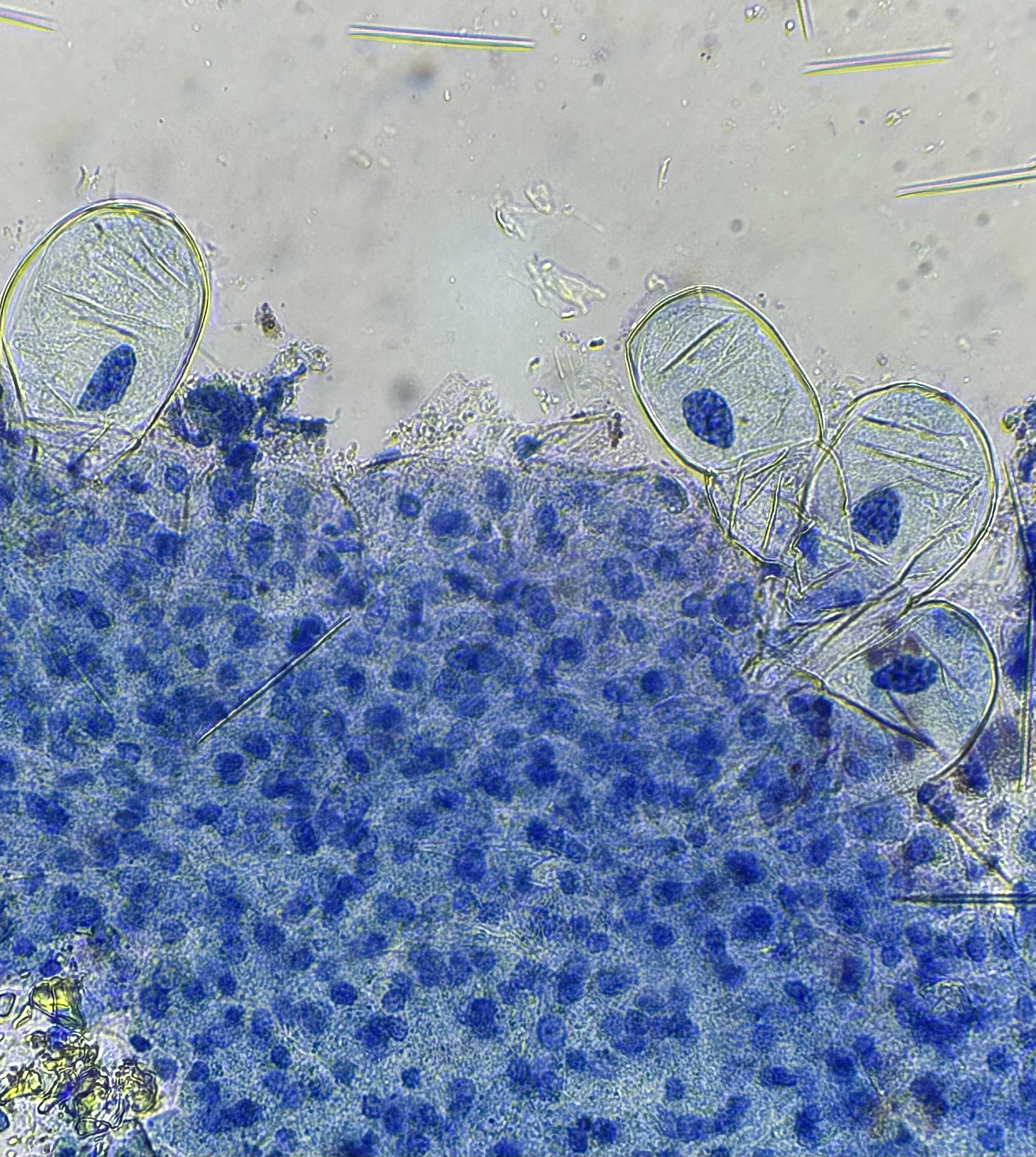 Near the top are four differentiated/specialized epidermal cells originating from the meristematic tissue below at 400x